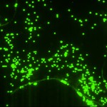 Acquired-Picture-of-2-um-pore-membrane-after-bead-flow-2-ul-concentration1