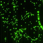 Acquired-Picture-of-2-um-pore-membrane-after-bead-flow-2-ul-concentration2