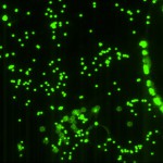 Acquired-Picture-of-2-um-pore-membrane-after-bead-flow-2-ul-concentration3