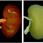 SongOtt_2013_decell-pig-kidney