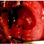 SongOtt_2013_implant-2
