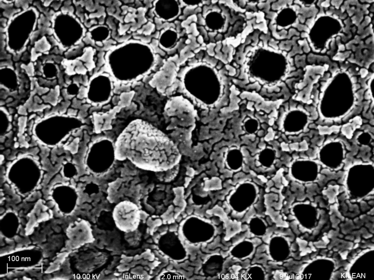 Immunogold Labeling of Exosomes
