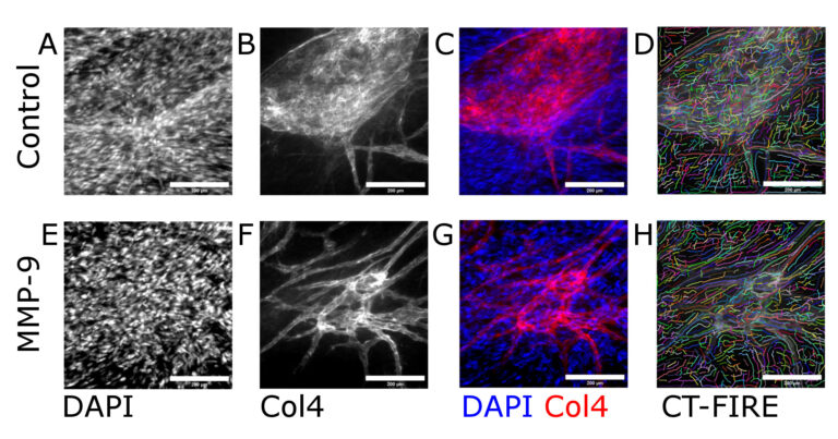 Measuring changes in endothelial basement membrane integrity