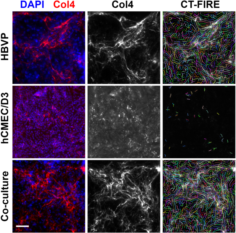 Collagen IV deposition by hCMEC/D3 (endothelial cell) and HBVP (pericyte) co-cultures in the μSiM-hNVU