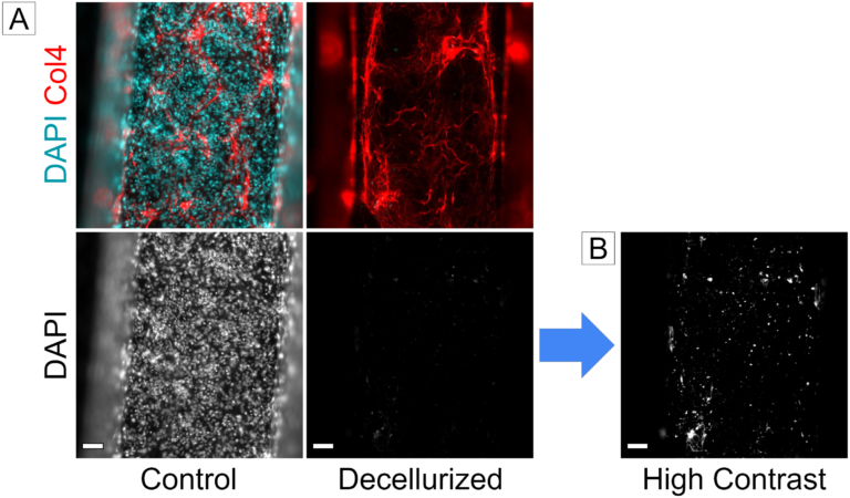 Progress Toward Modeling Inflammation-Mediated Degradation of Basement Membrane Proteins in the μSiM-hNVU