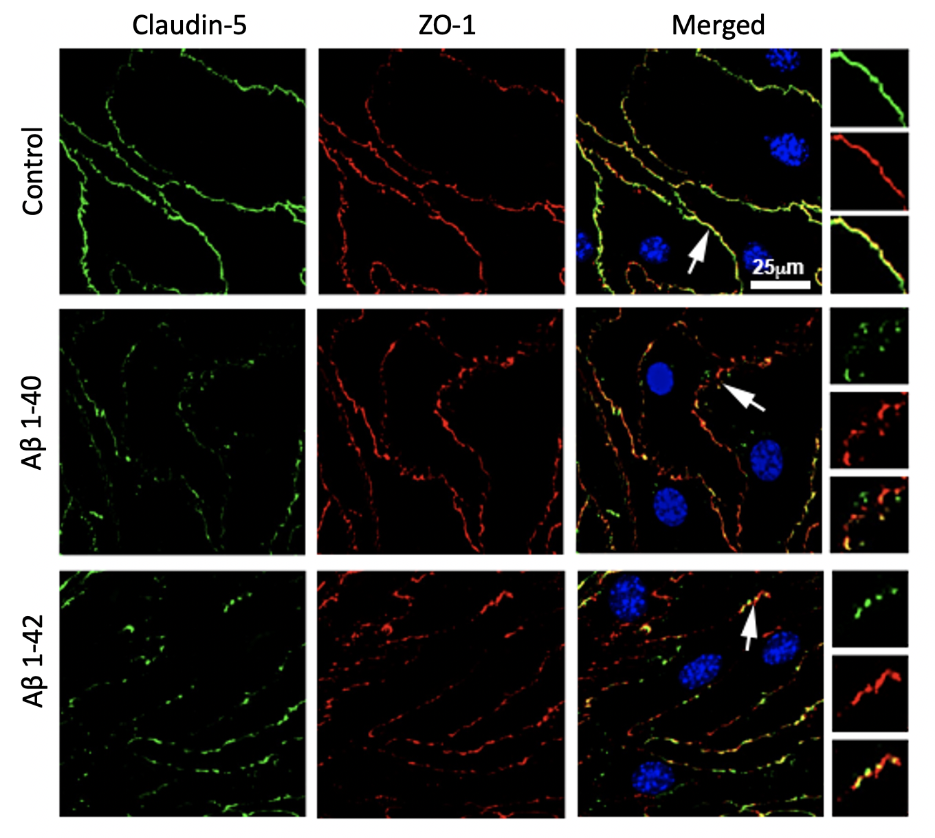 Utilizing the μSIM to model brain endothelial barrier changes in Cerebral Amyloid Angiopathy