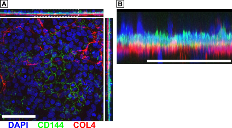 Updates on Modeling the Vascular Basement Membrane in the μSiM-hNVU