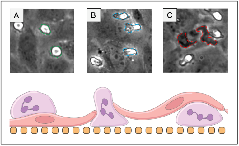 Merging Man with Machine: A Computer Vision Aided Leukocyte Transmigration Assay