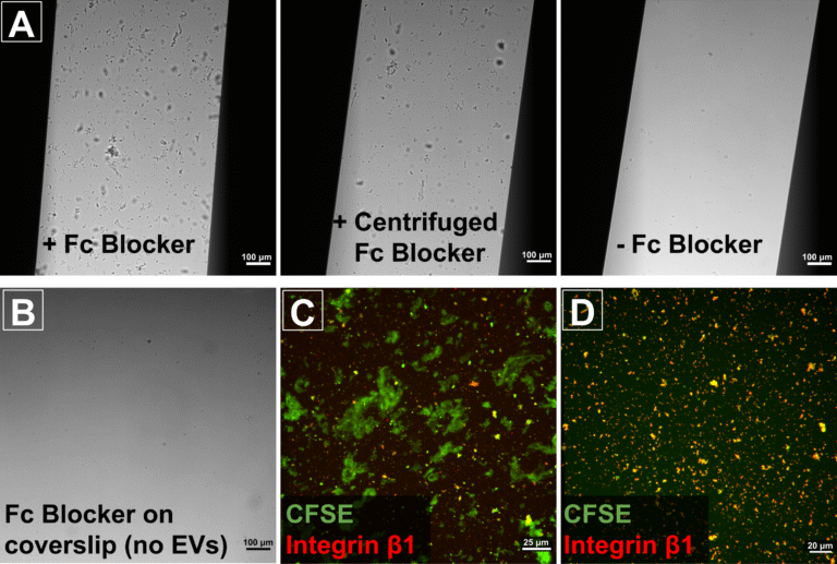 Fc Receptor Binding Inhibitor Aggregation Issues in the CAD-LB Platform
