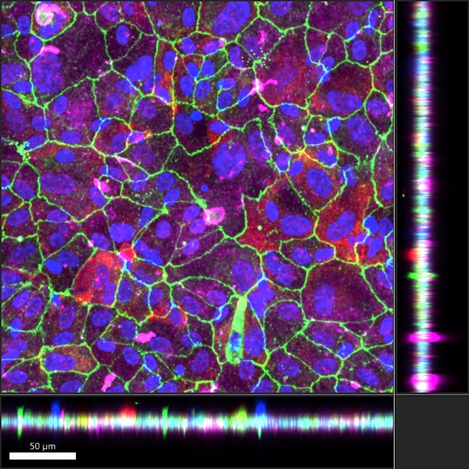 Development of Arising Retinal Pigment Epithelium-19 (ARPE-19) Barrier Tissues on NPN