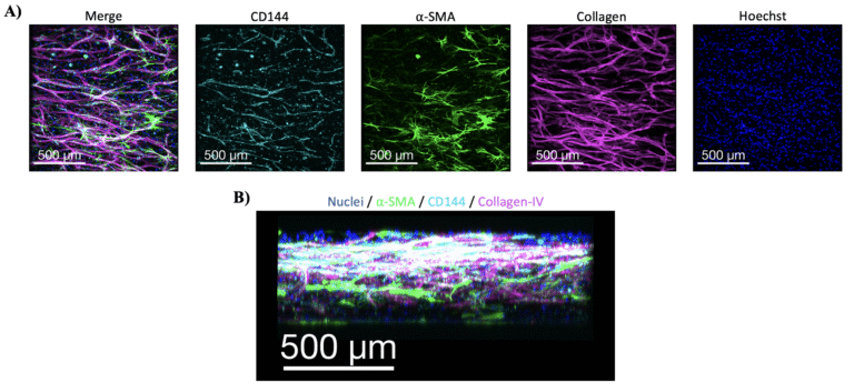 Vascularizing the Retinal-Barrier-on-a-chip Part 1: Key Factors in Preparing the Fibrin Gel
