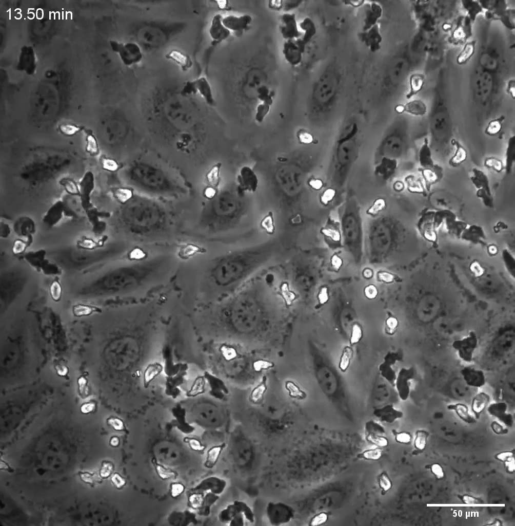 Leukocyte Transmigration