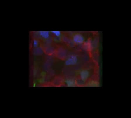 Membrane Imaging &mdash; Track-Etched