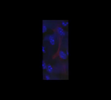 Membrane Imaging &mdash; Ultrathin Nanomembrane